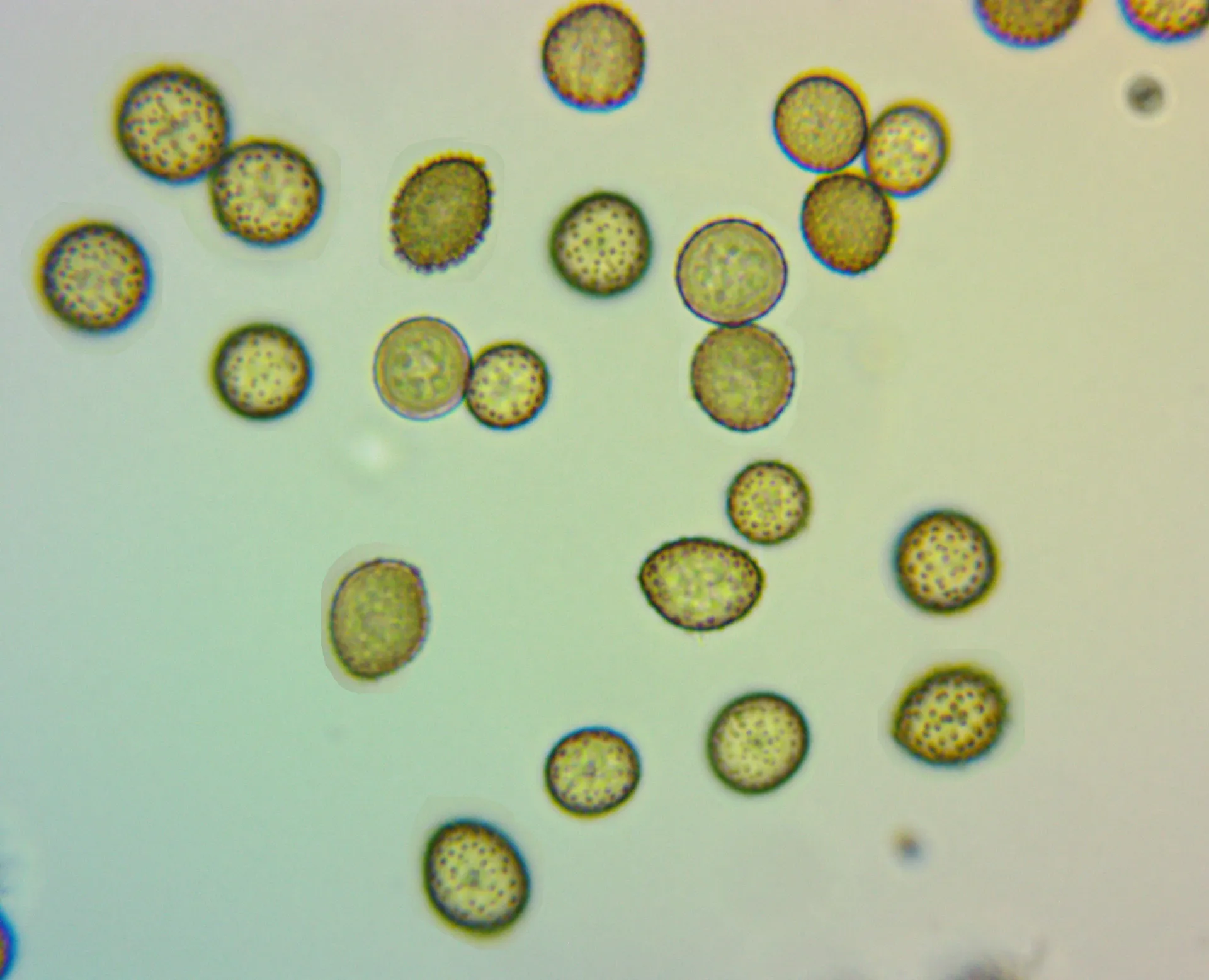 Microscopía de Mycosarcoma maydis - esporas, 1000X